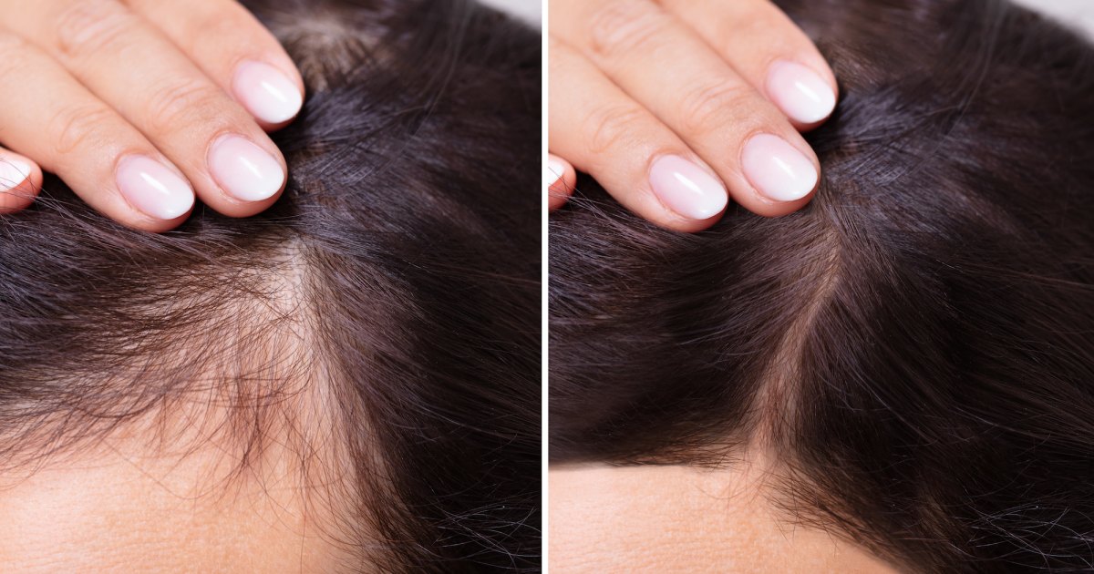 Find Out Why Shoppers ‘Can’t Go Without’ This Hair Growth Supplement