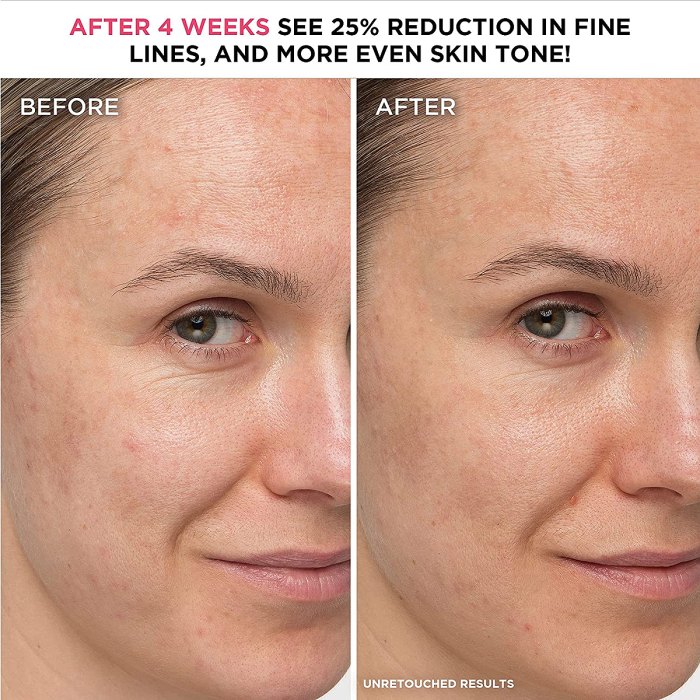 amazon-it-cosmetics-confidence-in-a-cream-before-after