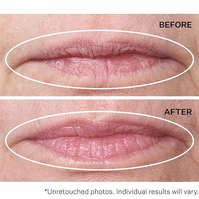This 2-in-1 Treatment Is Here to Plump Up Shriveled Lips — On Sale!