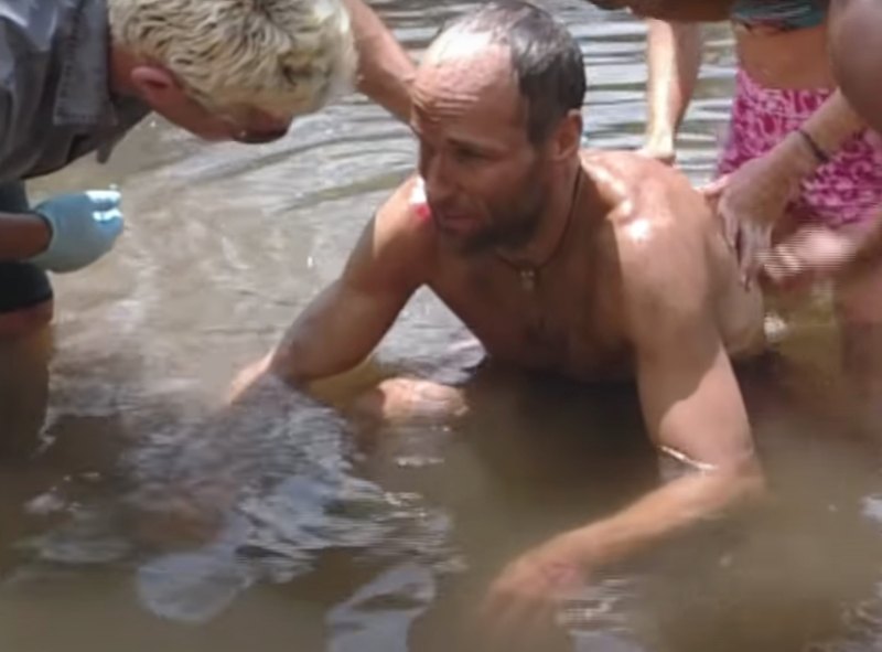 Every 'Survivor' Contestant Who Was Medically Evacuated from the Game - 993 Michael Skupin