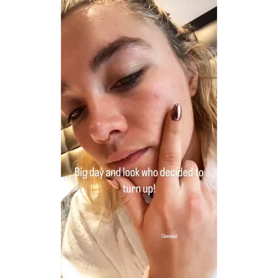 Florence Pugh Jokes About Pimple Before Hitting 2023 Oscars Red Carpet