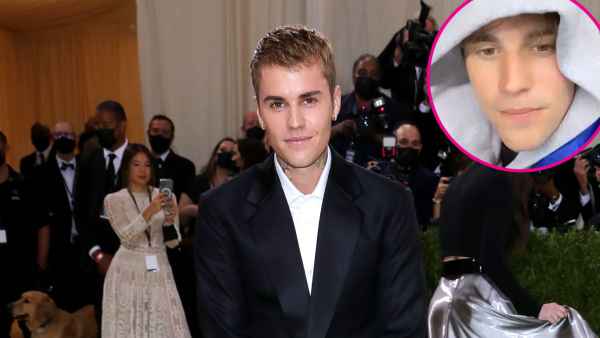 Promo Justin Bieber Shows Off Mobility in His Face Following Ramsay Hunt Syndrome Diagnosis
