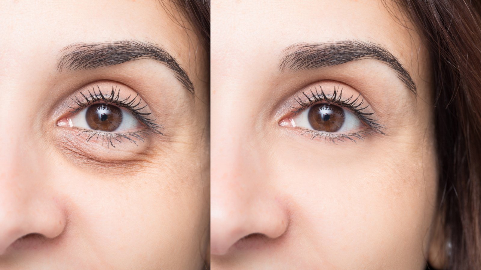 Puffy-Eye-Before-After-Stock-Photo