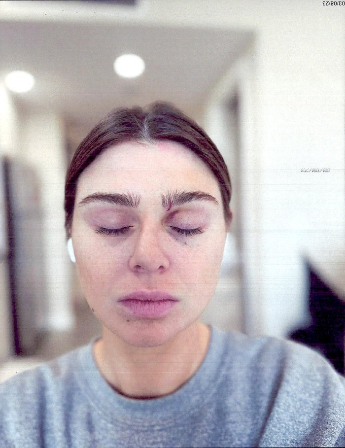 Raquel Leviss, do Vanderpump Rules, confirma as alegações de que Scheana Shay deu um soco na cara dela após o caso de Tom Sandoval - fotos - 461