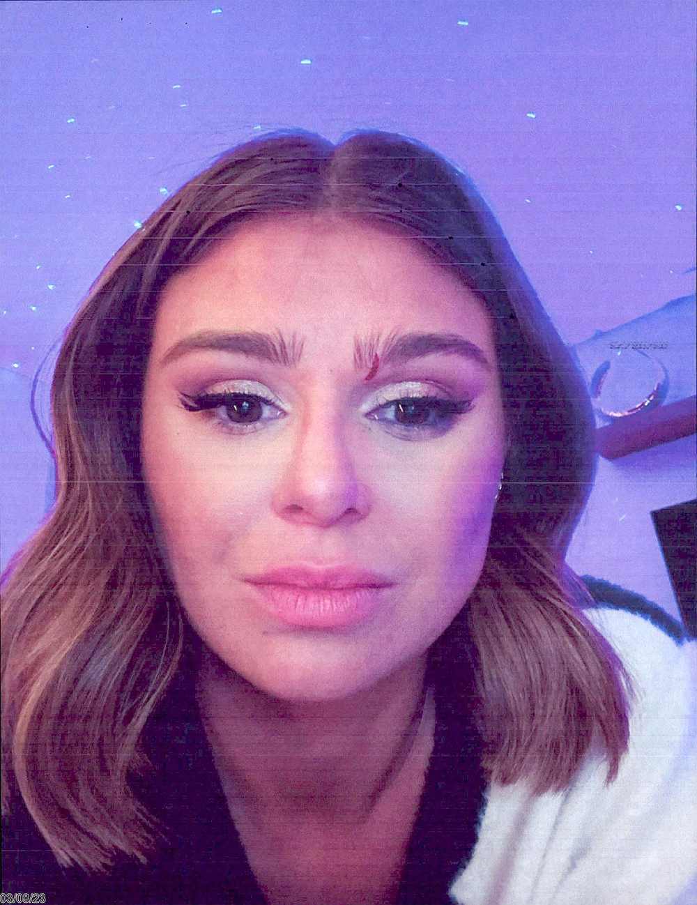 Vanderpump Rules&rsquo; Scheana Shay Denies Punching Raquel Leviss, Claims Bruise Photos Are Fake - 510