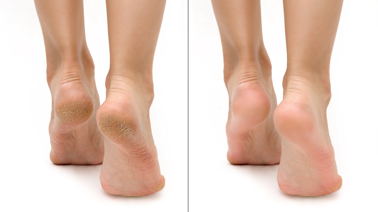 Before-After-Pedicure-Foot-Stock-Photo