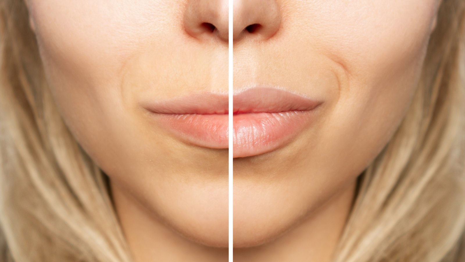 Plup-Lips-Before-After-Stock-Photo