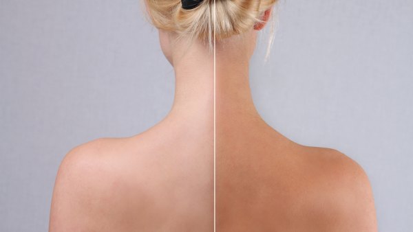 Self-Ran-Before-After-Results-Stock-Photo