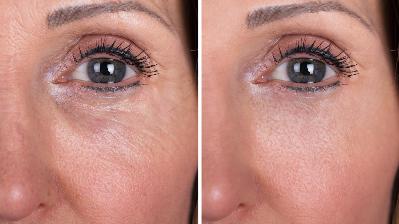 Wrinkle-Closeup-Before-After-Stock-Photo
