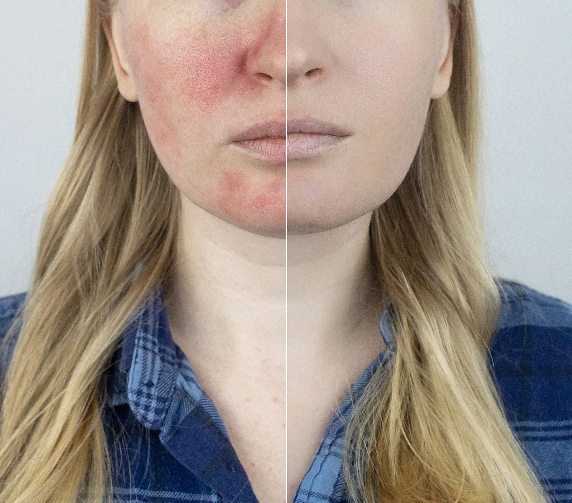 Evian Facial Spray Has 'Endless Benefits' for Skin