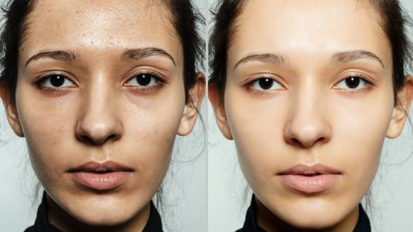 Skin-Close-Up-Before-After-Shot-Stock-Photo