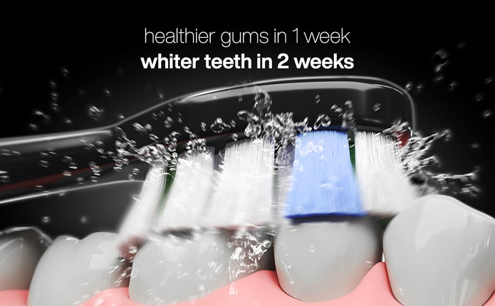 amazon-aquasonic-toothbrush-healthy-gums-white-teeth