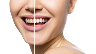 amazon-aquasonic-toothbrush