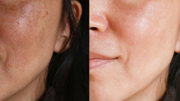 amazon-goodal-vitamin-c-serum