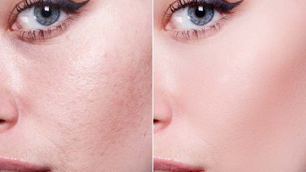 amazon-vichy-double-glow-peel-mask