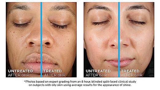 Bid Farewell to Oily Skin with this Must-Have Moisturizer