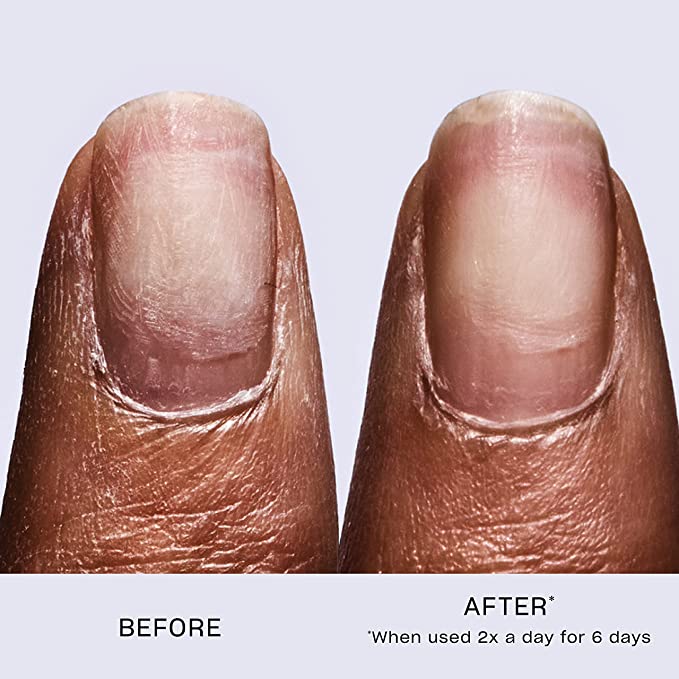 Revive and Transform Your Nails in Just 6 Days With This Ultimate Strengthening Treatment