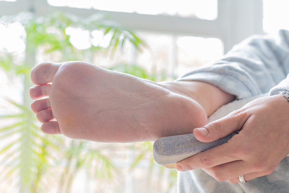The Best Callus Removers for Pampering Your Feet At-Home