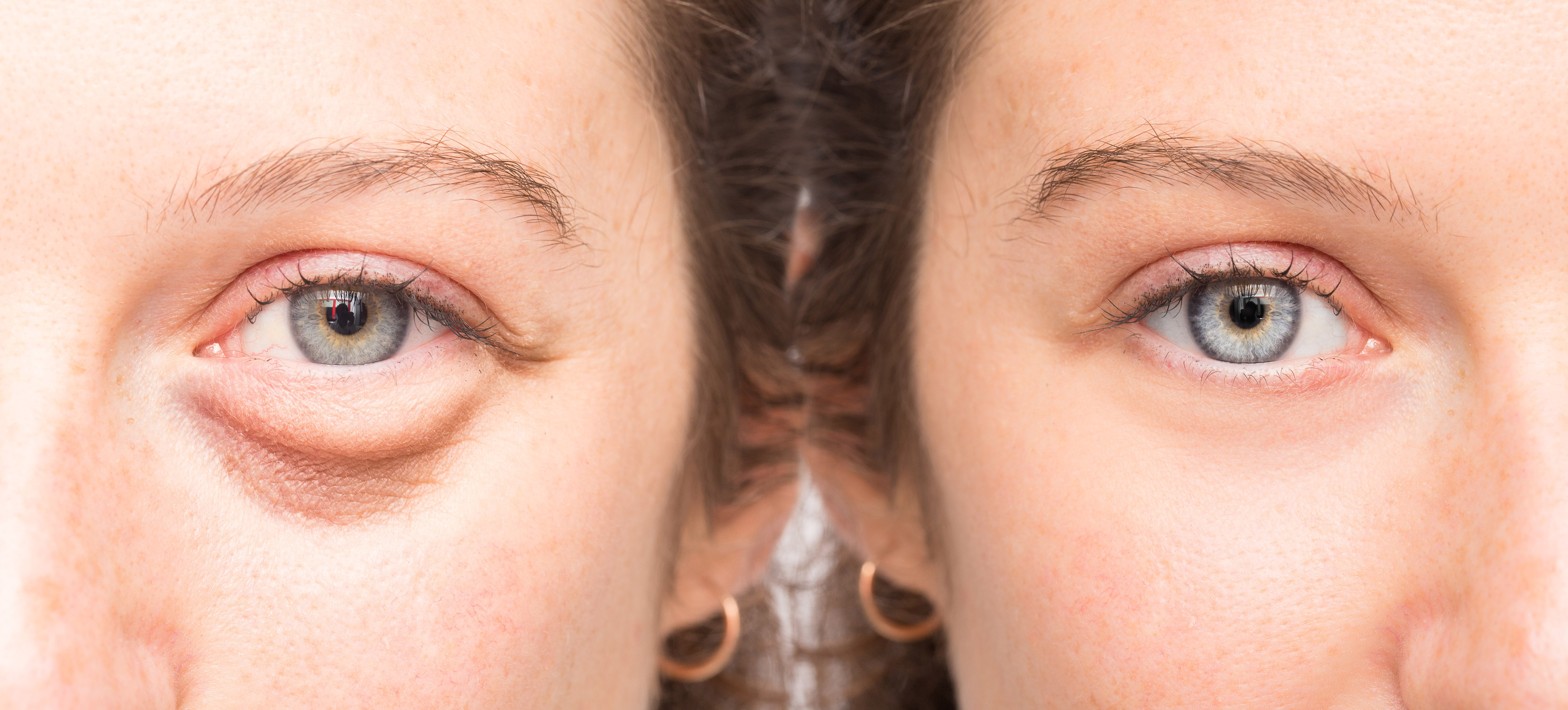This Serum Works Like 'Magic' to Erase Wrinkles and Under-Eye Bags