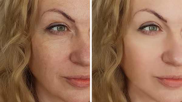 cosrx-retinol-cream