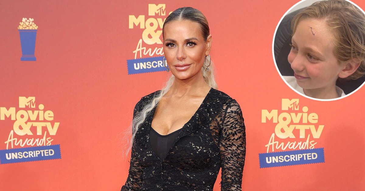 Dorit Kemsley’s Son Jagger Got Stitches After Baseball Bat Accident Dorit Kemsley’s Son Jagger Got Stitches After Baseball Bat Accident