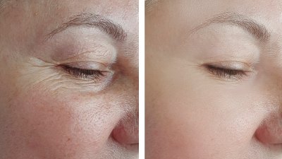 wealthskin-eye-serum-amazon-beauty