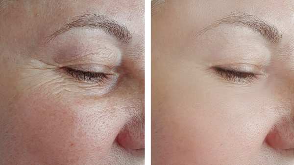 wealthskin-eye-serum-amazon-beauty