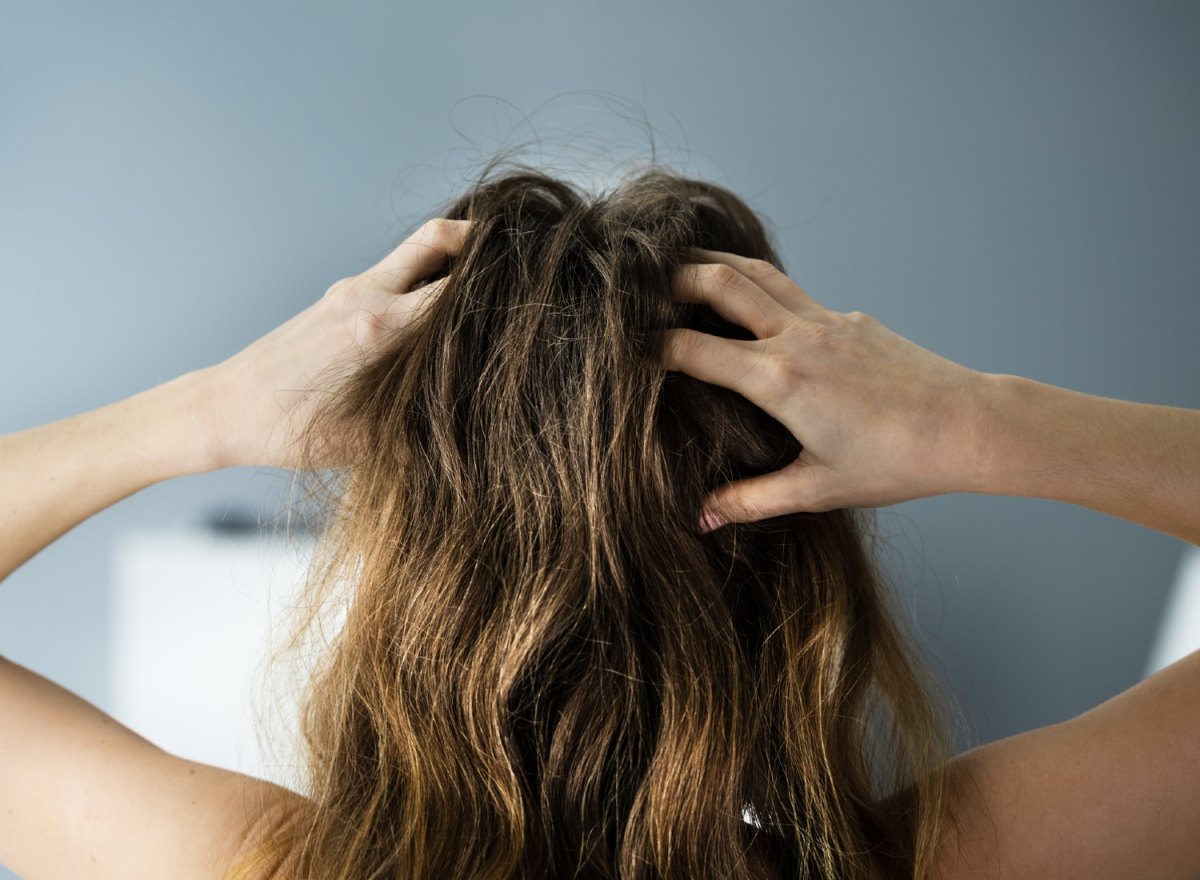 Woman scratching her head