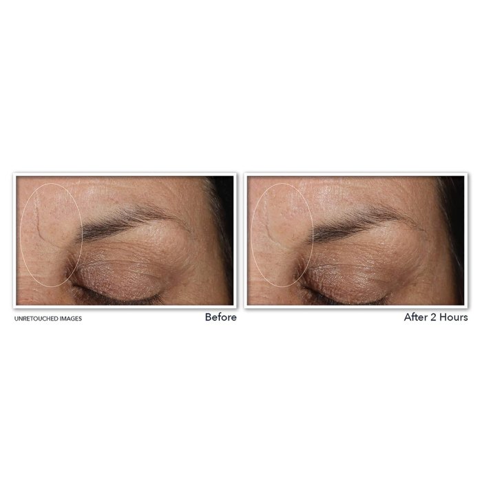roc-wrinkle-patches-11-lines