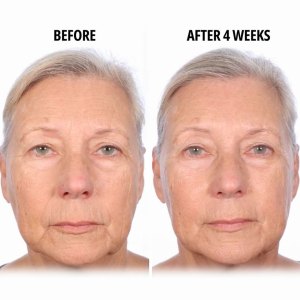 serious-skincare-trace-erase