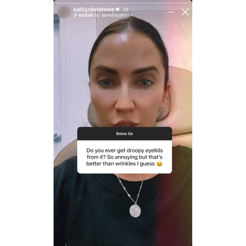 Kaitlyn Bristowe Sort Of Offers Botox Advice While Getting a Lip Flip