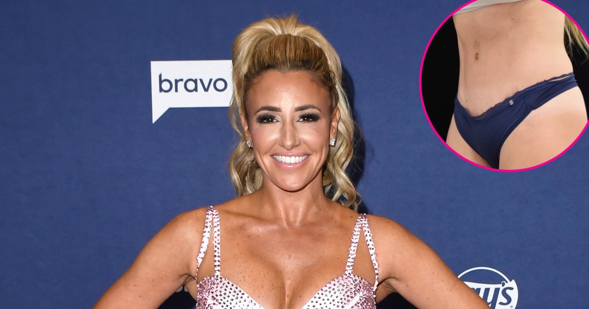 RHONJ Star Danielle Cabral Reveals Tummy Tuck Results After Commenting on Peoples Ozempic Use Promo