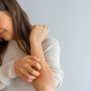Best Laundry Detergent for Eczema