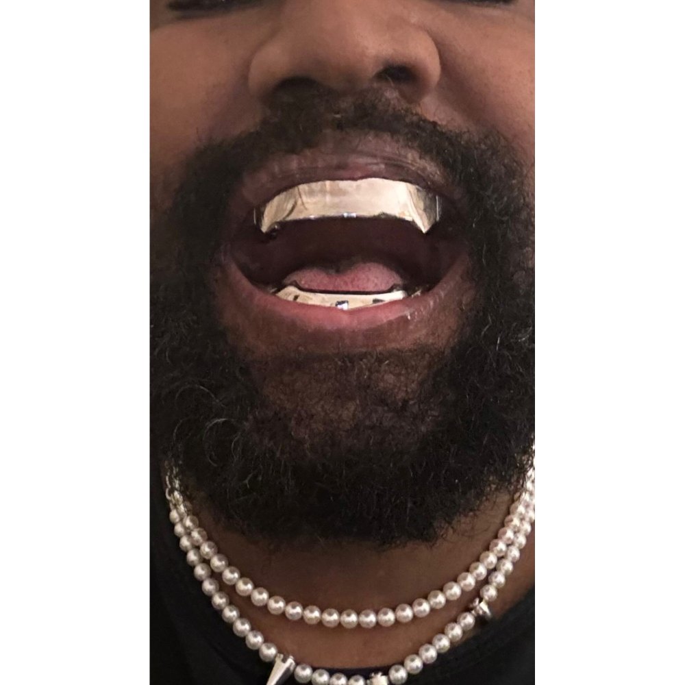 Kanye West Shows Off $850,000 Titanium Grill Inspired by James Bond Villain