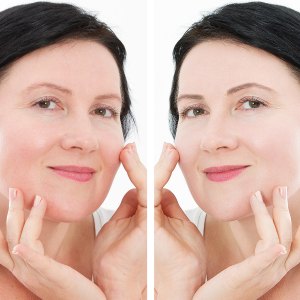 Middle age close up woman happy face before after cosmetic procedures. Skin care for wrinkled face. Before-after anti-aging facelift treatment. Facial skincare and contouring. Beauty and make-up