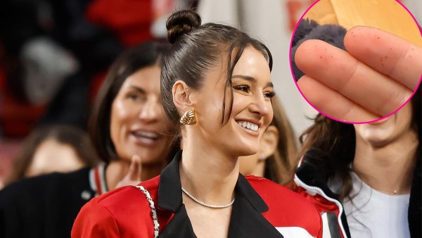Kristin Juszczyk Has Scars From Accidentally Pricking Fingers From Sewing Super Bowl Merch 611
