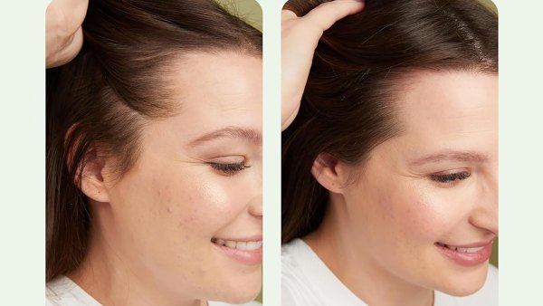 amazon-divi-scalp-serum-before-after