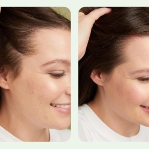 amazon-divi-scalp-serum-before-after