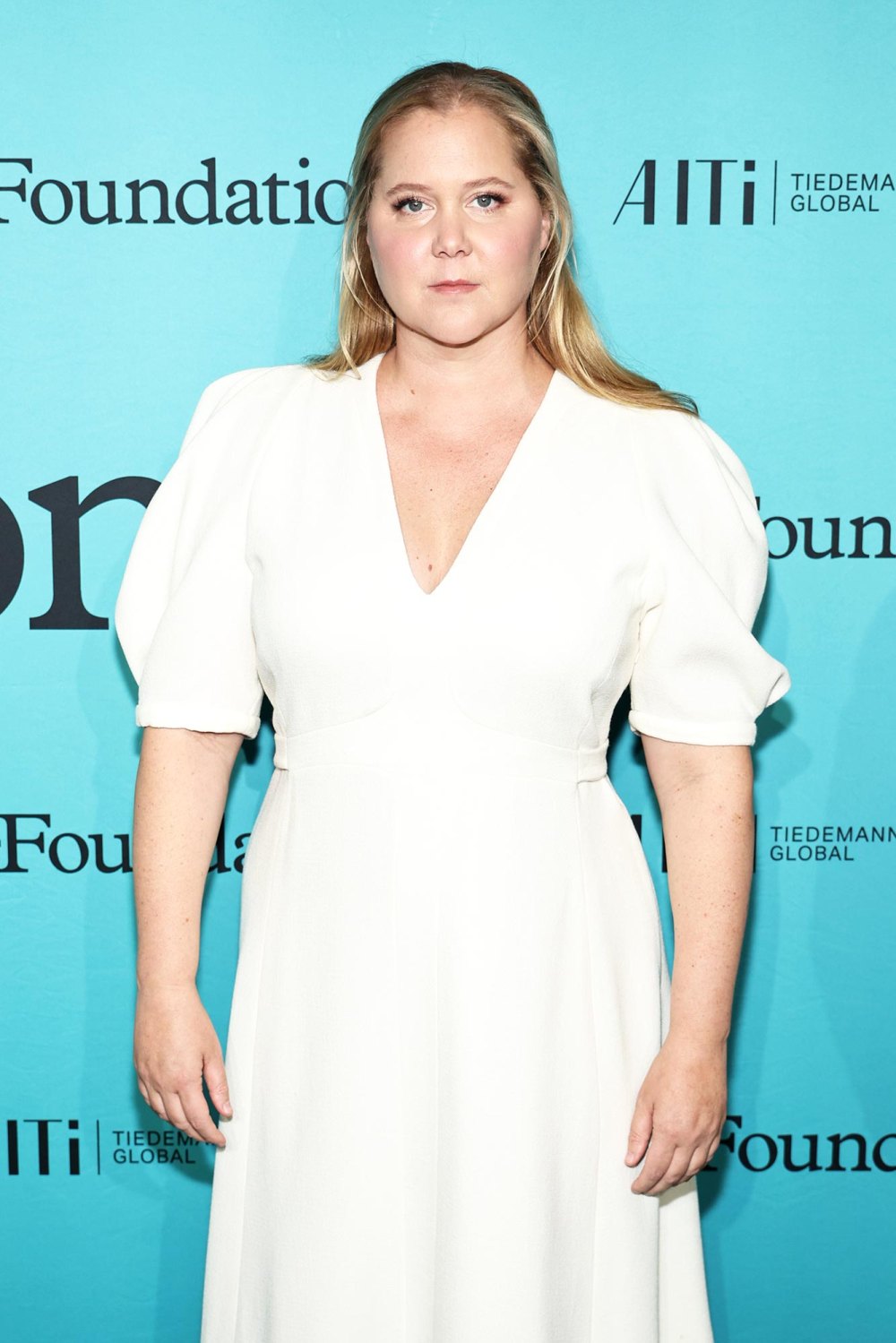 Amy Schumer Feels Reborn After Puffy Face Comments Led to Cushing Syndrome Diagnosis