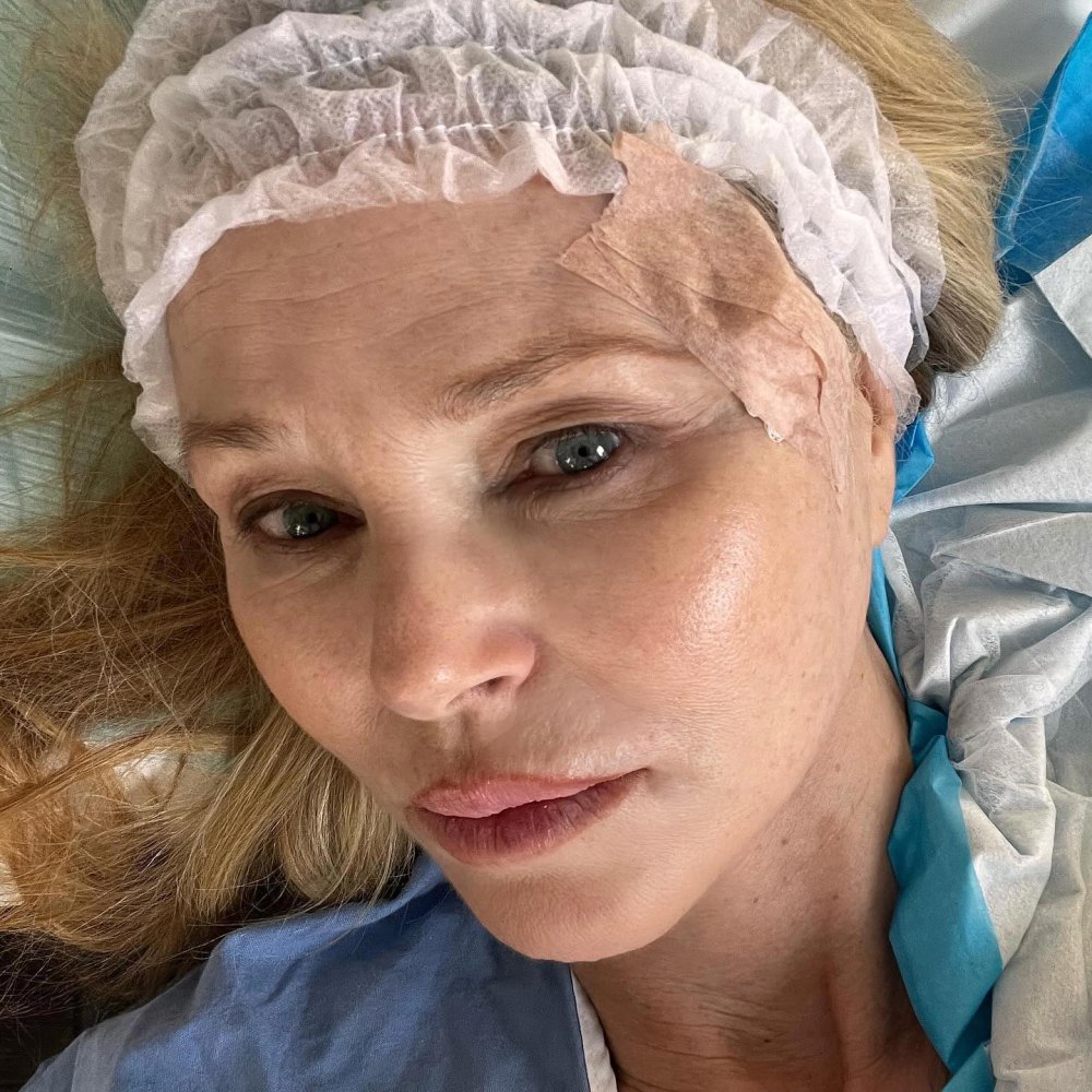 Christie Brinkley Reveals Skin Cancer Diagnosis: 'We Caught the Basal Cell Carcinoma Early'