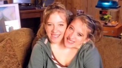 Conjoined twins Abby Hensel and Brittany Hensel Josh Bowling