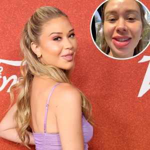 Gabby Windey Revealed Her Swollen Lips After Getting Filler Dissolved Help