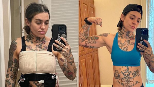 Morgan Wade Is ‘Still Adjusting’ to Her Body Following Double Mastectomy