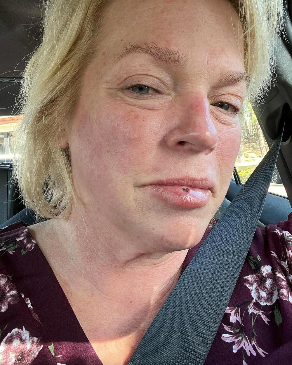 Sister Wives Janelle Brown Urges Fans to Get Checked After Removing Pre Cancerous Lump 370