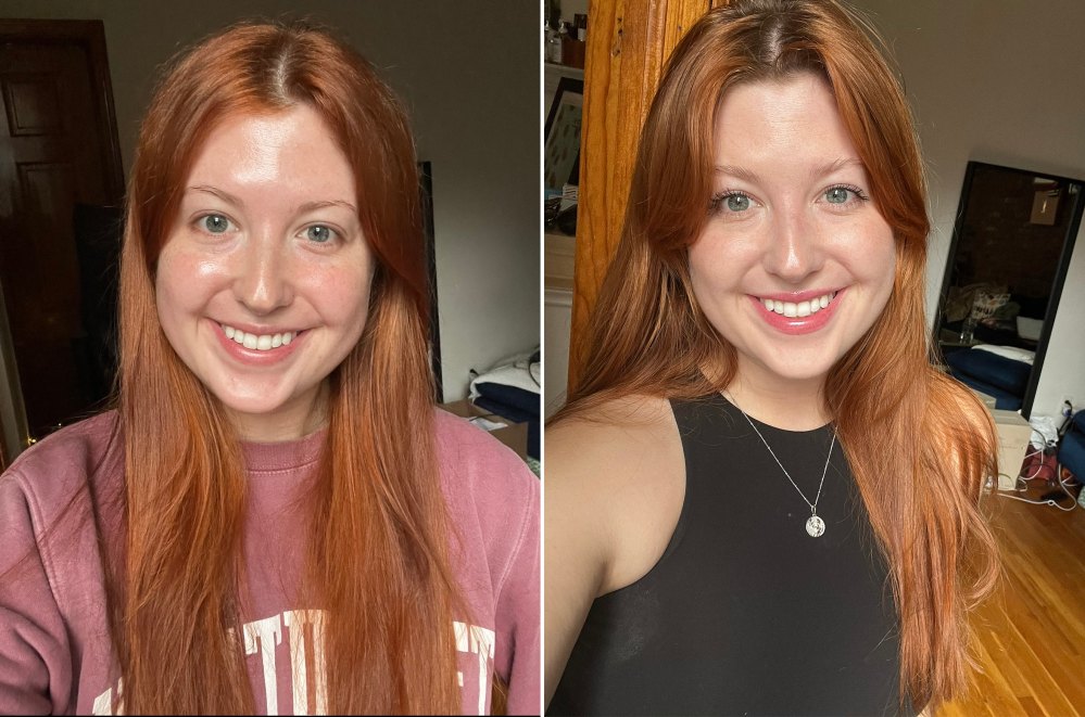 boka-whitening-strips-before-after