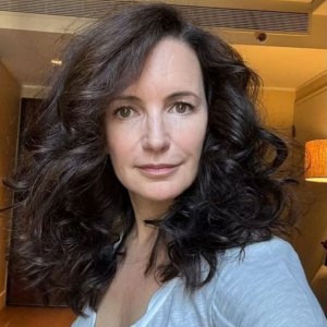 Kristin Davis shows off fresh face after dissolving fillers