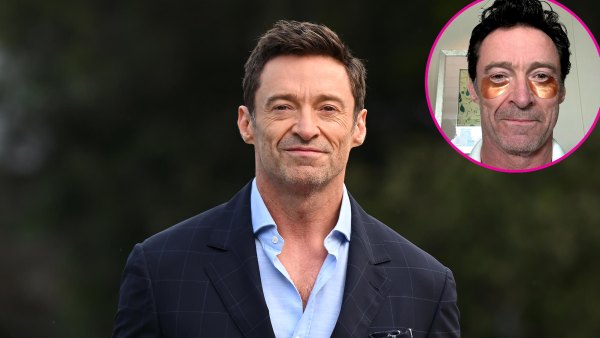 Hugh Jackman Practices Self-Care With Rose Gold Eye Masks- ‘This Is 55’