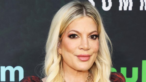 Tori Spelling Shares Why She Got Veneers