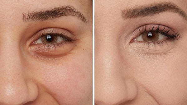 before and after concealer picture of woman for IT Cosmetics