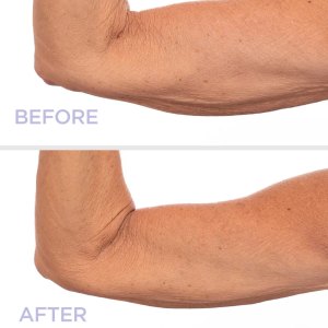 GoPure Sculpt and Tone Arm Cream